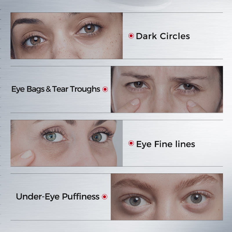 Eye Patches for Dark Circles – - Sheet Mask Collagen avis et prix