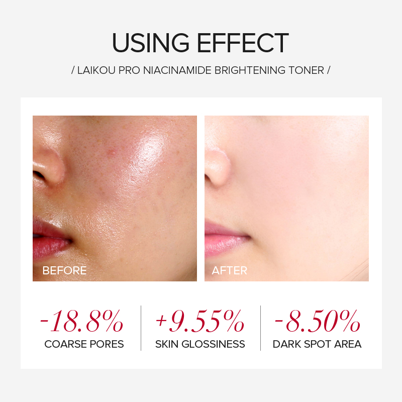 LAIKOU PRO Niacinamide 4Pcs Br - Korean Skincare Routine avis et prix