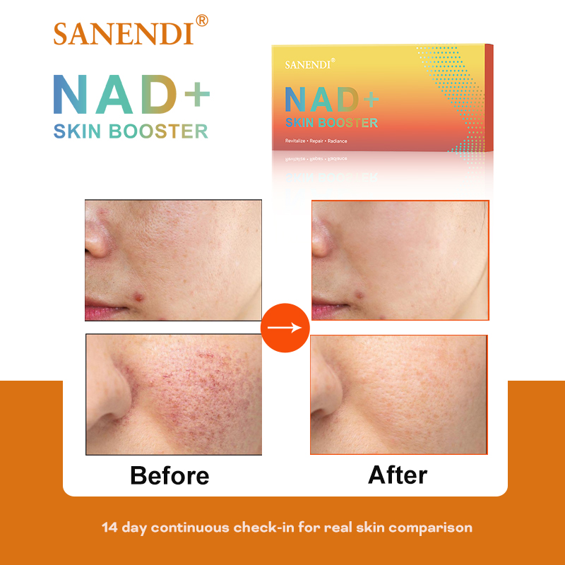 Sanendi NAD+ Korea Skincare Pr - Korean Skincare Routine avis et prix