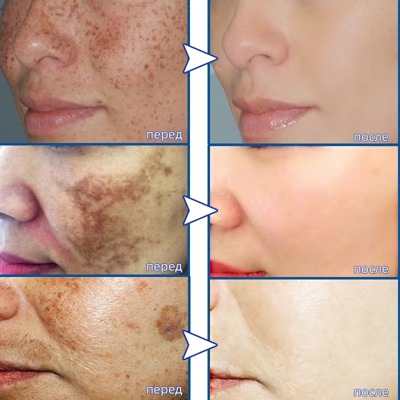Powerful Spot-removing Whiteni - Korean Skincare Routine avis et prix