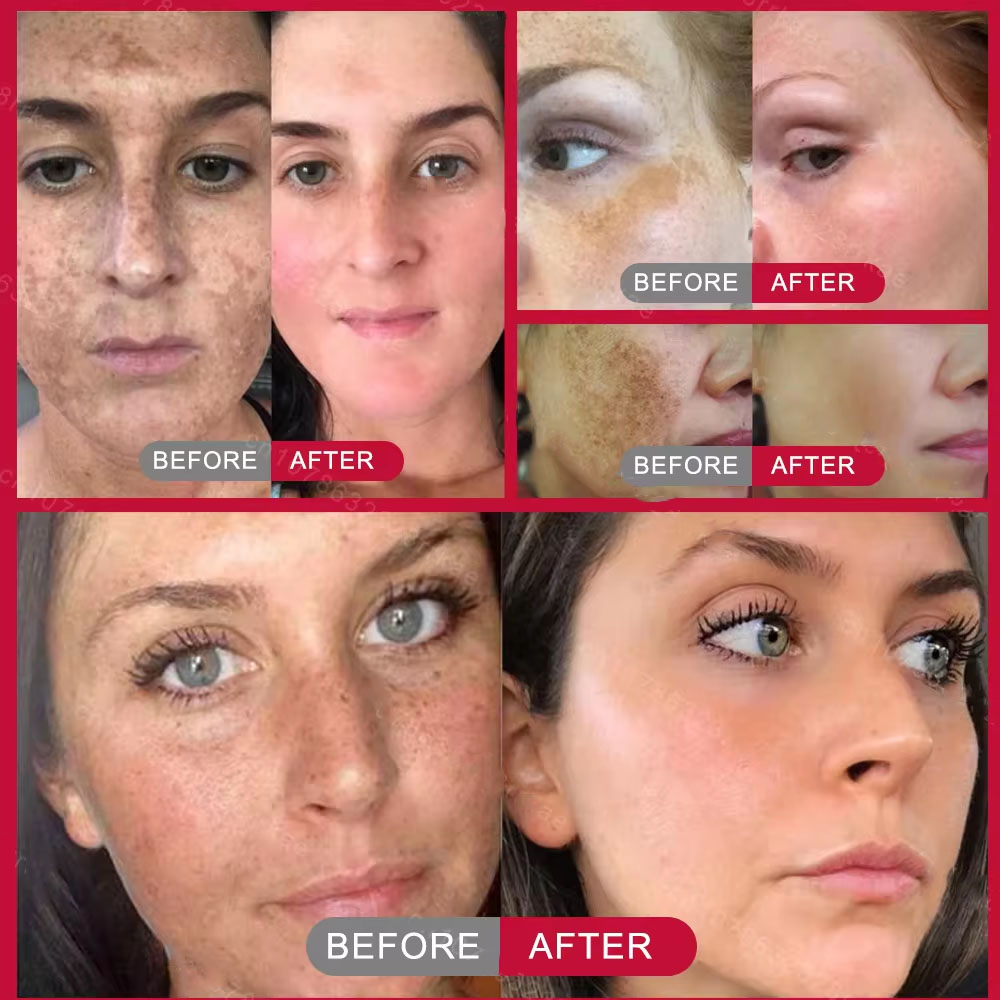 Powerful Spot-removing Whiteni - Korean Skincare Routine avis et prix