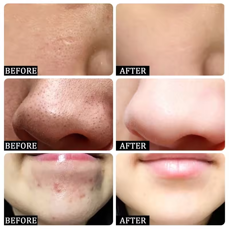 Pore Shrinking Cream Eliminati - Korean Skincare Routine avis et prix