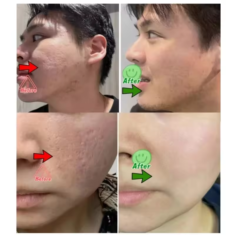 Pore Shrinking Cream Eliminati - Korean Skincare Routine avis et prix