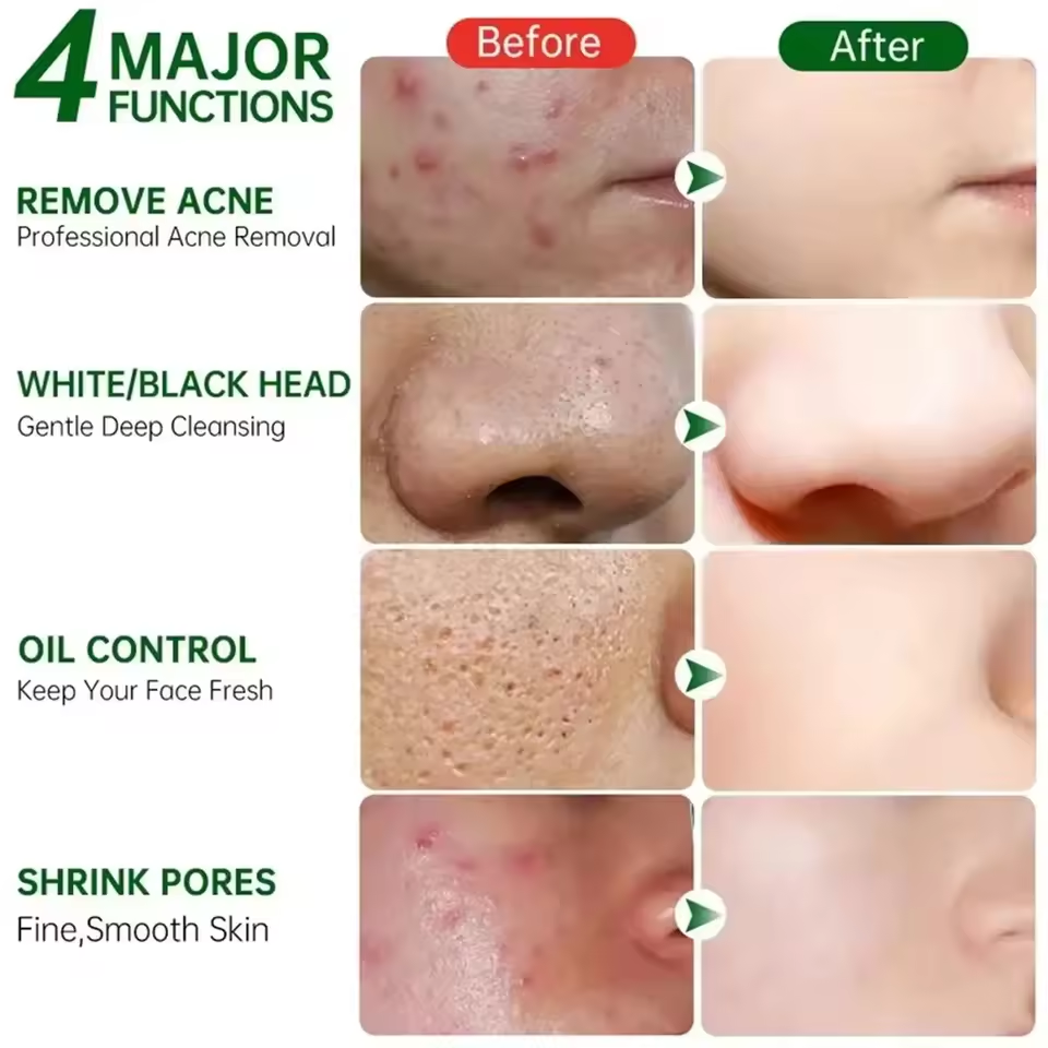 Pore Shrinking Cream Eliminati - Korean Skincare Routine avis et prix