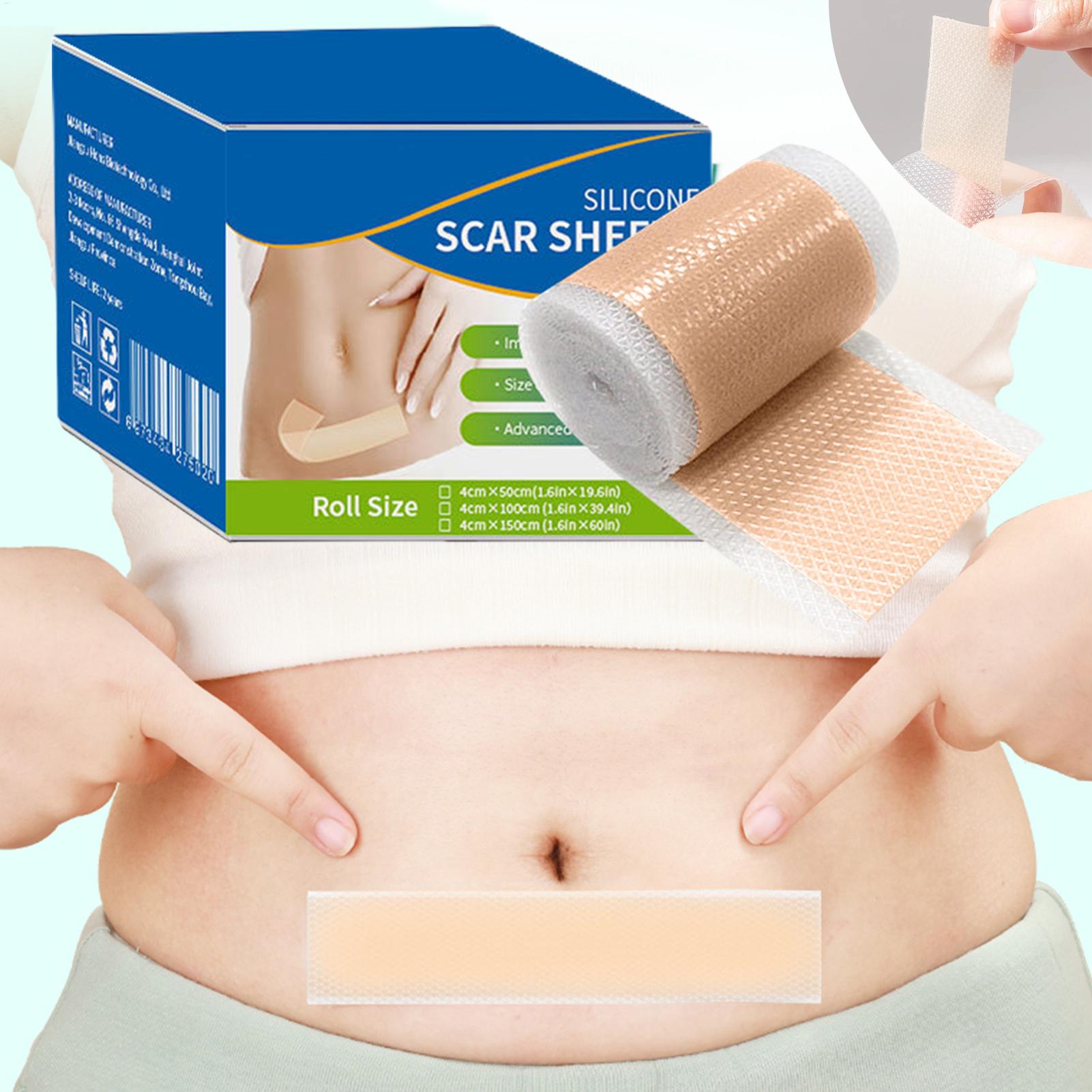 1 Roll Silicone Scar Sheets 4c - Sheet Mask Collagen avis et prix